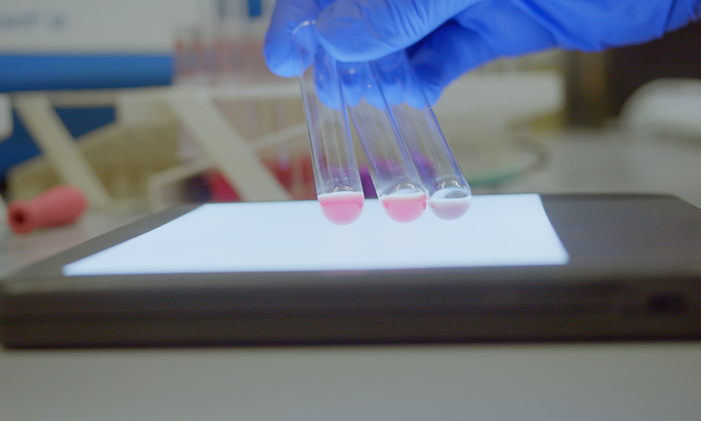 germany_greifswald_blood_11